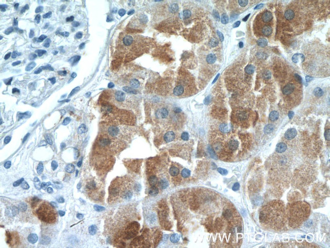 IHH Antibody in Immunohistochemistry (Paraffin) (IHC (P))