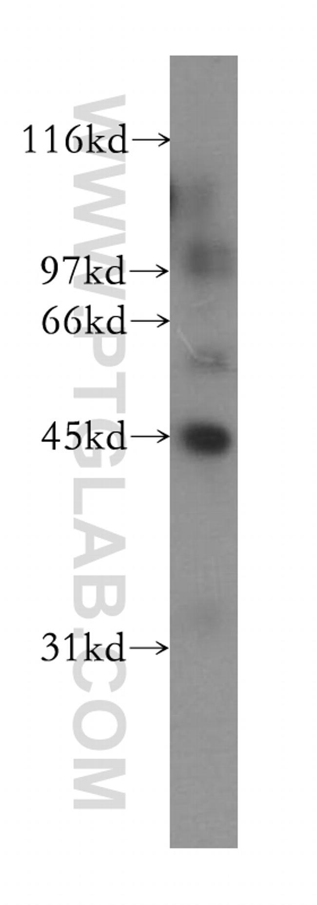 IHH Antibody in Western Blot (WB)