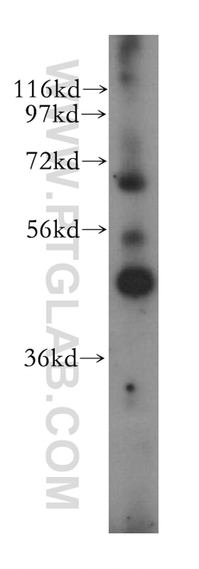 IHH Antibody in Western Blot (WB)