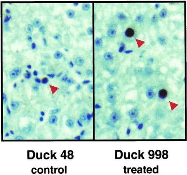 PCNA Antibody in Immunohistochemistry (IHC)