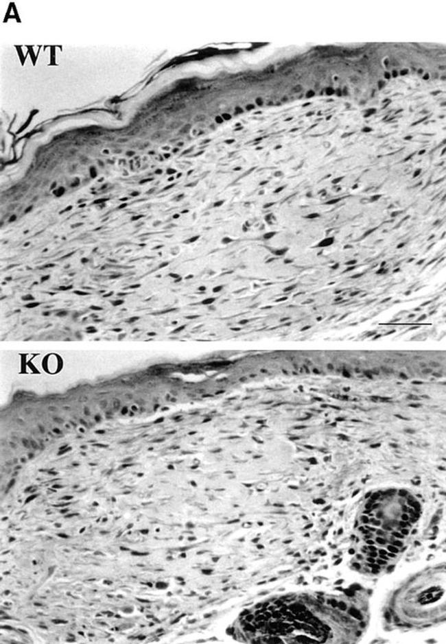 PCNA Antibody in Immunohistochemistry (IHC)