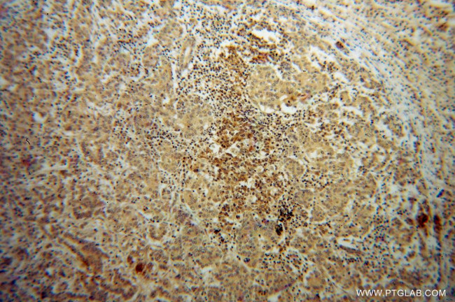 Galectin-4 Antibody in Immunohistochemistry (Paraffin) (IHC (P))