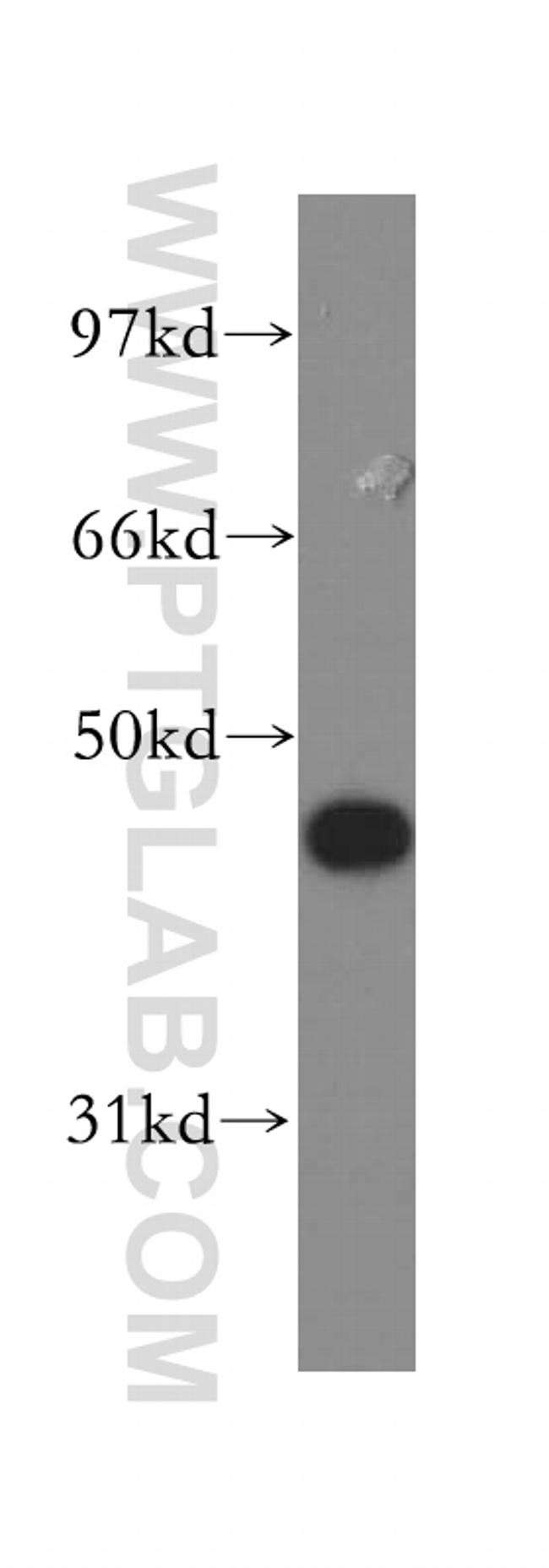 Galectin-4 Antibody in Western Blot (WB)