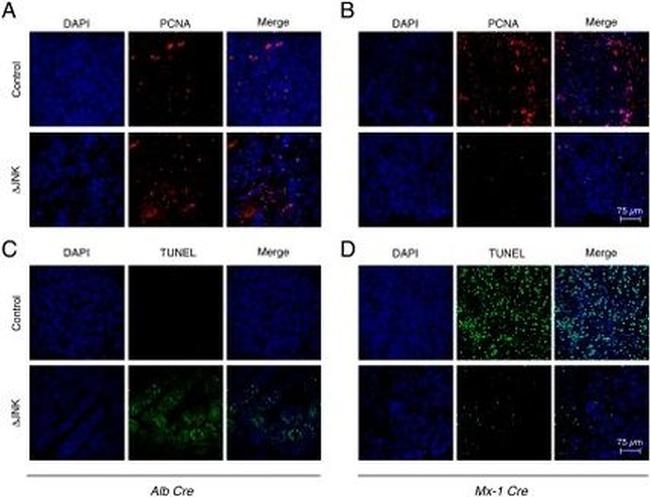 PCNA Antibody in Immunohistochemistry (Paraffin) (IHC (P))