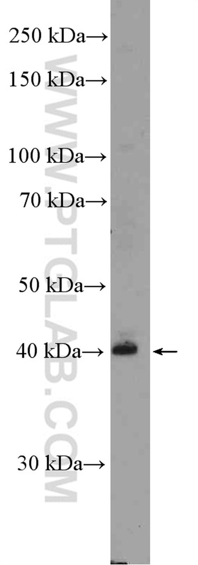 Zinc-alpha-2-glycoprotein Antibody in Western Blot (WB)