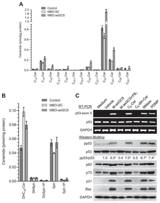 p53 Antibody in Western Blot (WB)