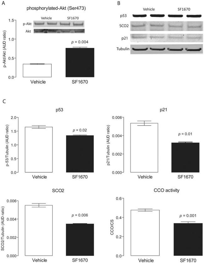 p53 Antibody in Western Blot (WB)