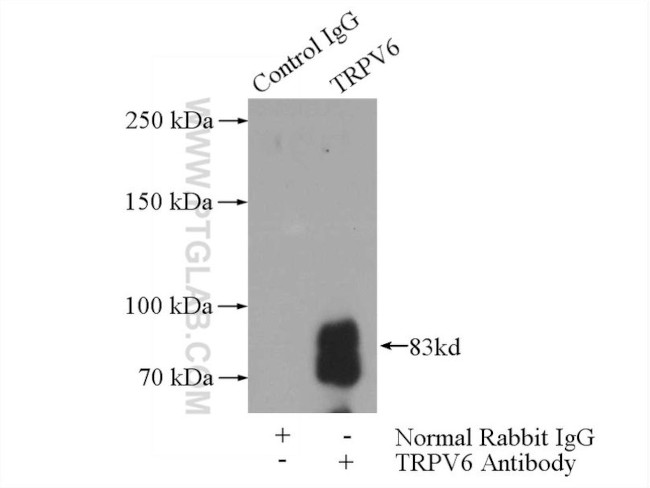 TRPV6 Antibody in Immunoprecipitation (IP)