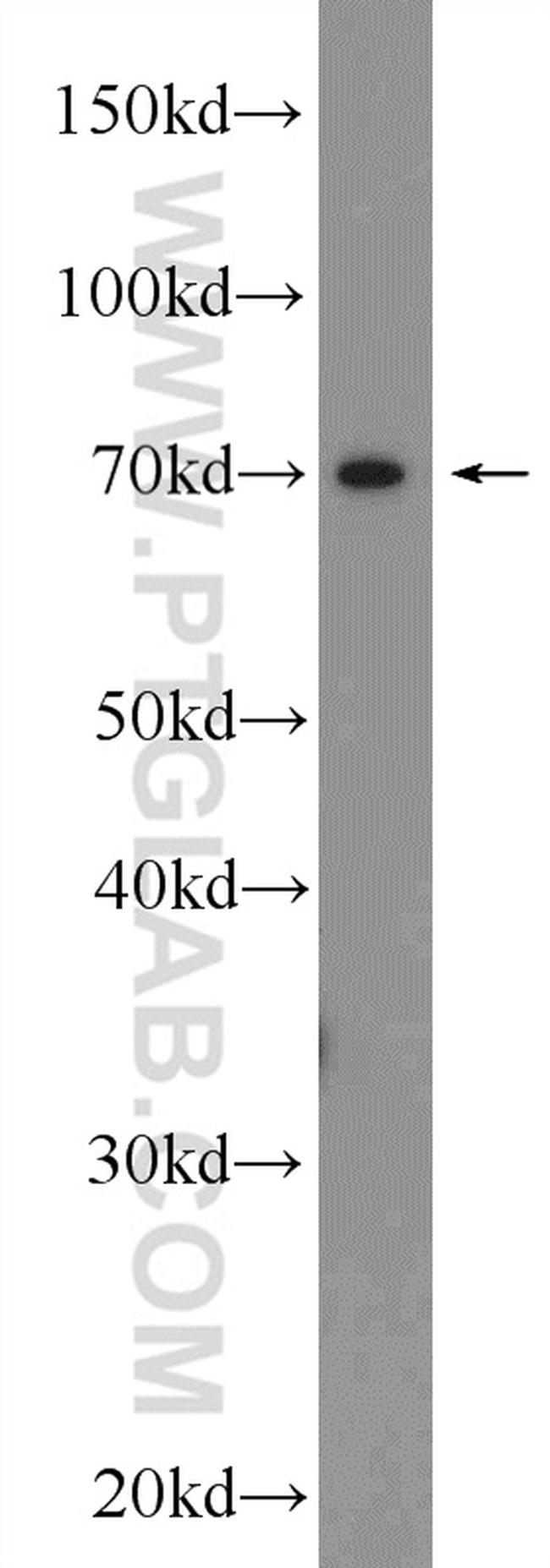 TRPV6 Antibody in Western Blot (WB)