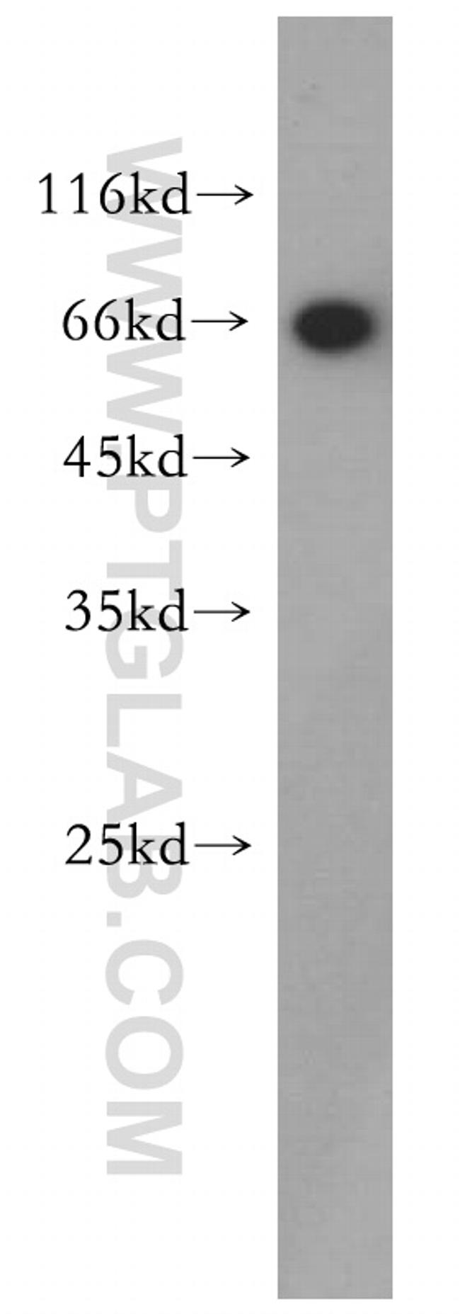 TRPV6 Antibody in Western Blot (WB)