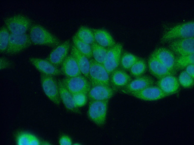 RAB27B Antibody in Immunocytochemistry (ICC/IF)