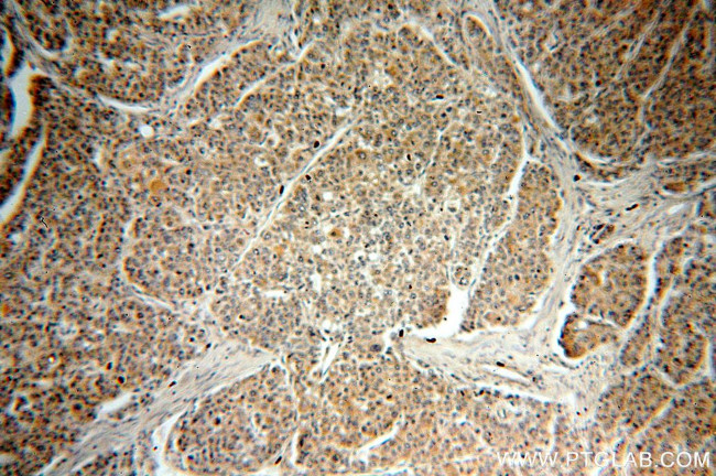 RAB27B Antibody in Immunohistochemistry (Paraffin) (IHC (P))