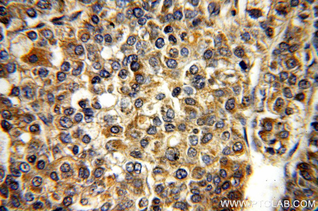 RAB27B Antibody in Immunohistochemistry (Paraffin) (IHC (P))