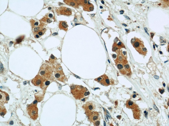 RAB27B Antibody in Immunohistochemistry (Paraffin) (IHC (P))