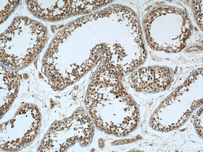 RAB27B Antibody in Immunohistochemistry (Paraffin) (IHC (P))