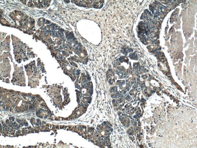 RAB27B Antibody in Immunohistochemistry (Paraffin) (IHC (P))