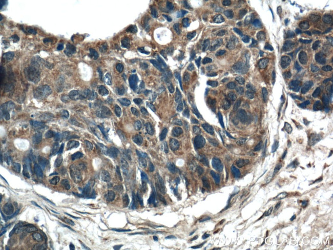 RAB27B Antibody in Immunohistochemistry (Paraffin) (IHC (P))