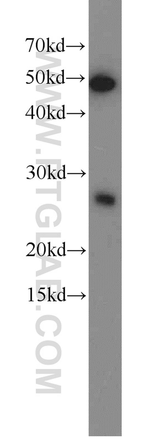 RAB27B Antibody in Western Blot (WB)