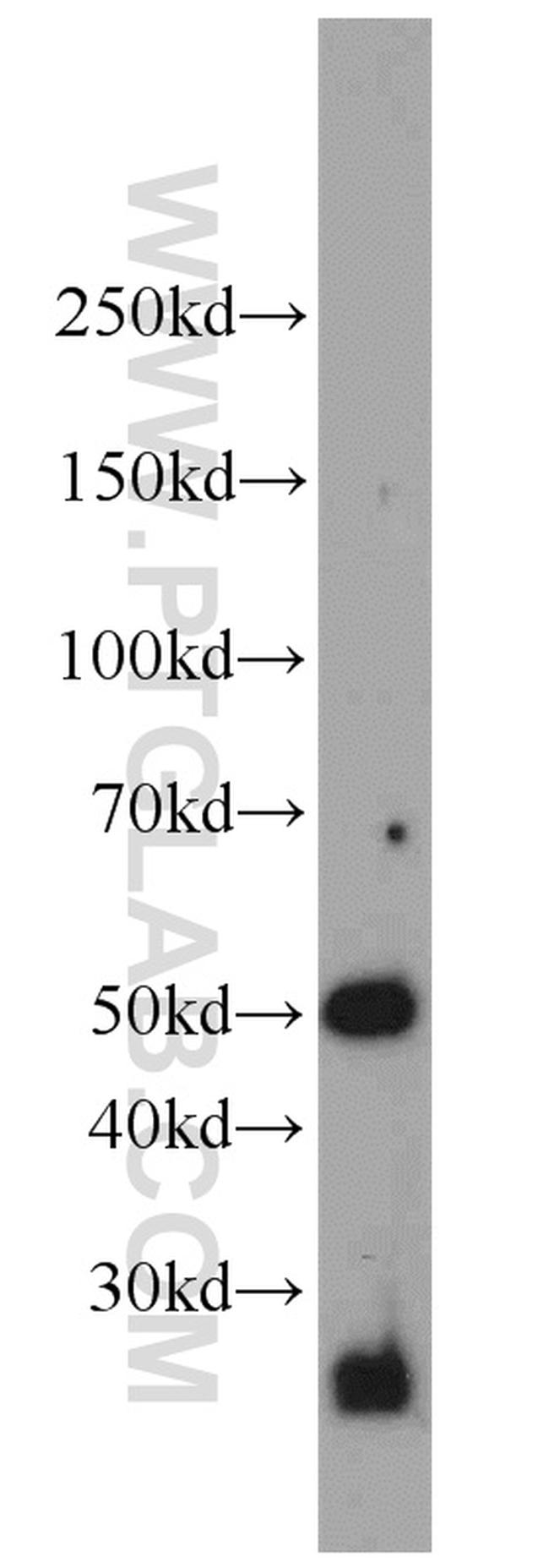 RAB27B Antibody in Western Blot (WB)