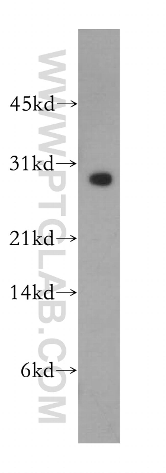 RAB27B Antibody in Western Blot (WB)