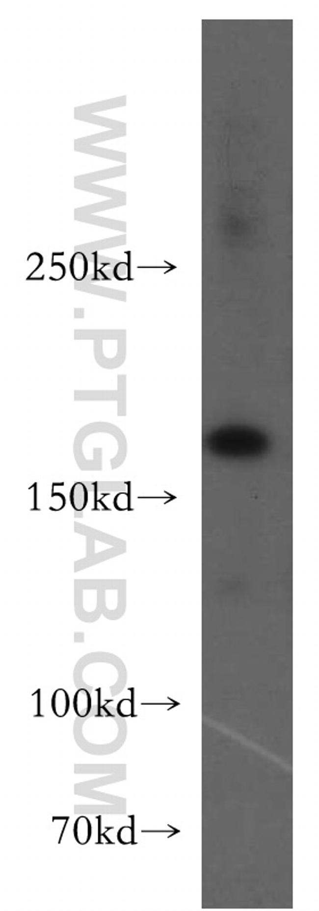 UGCGL2 Antibody in Western Blot (WB)