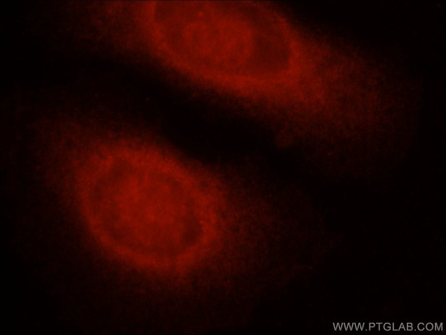 Caspase 8 Antibody in Immunocytochemistry (ICC/IF)