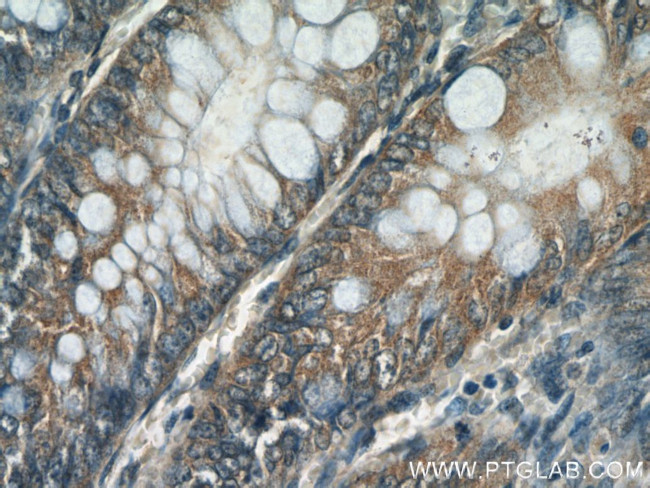 Caspase 8 Antibody in Immunohistochemistry (Paraffin) (IHC (P))