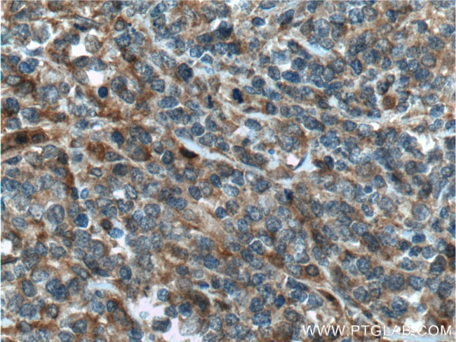 Caspase 8 Antibody in Immunohistochemistry (Paraffin) (IHC (P))