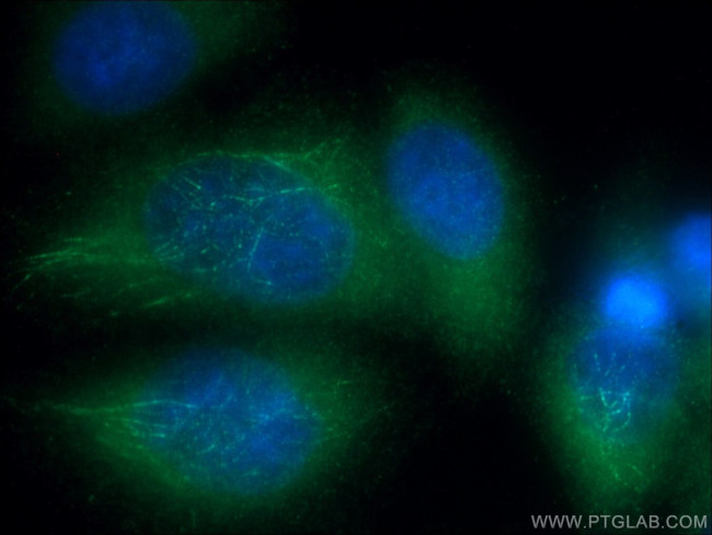 DVL3 Antibody in Immunocytochemistry (ICC/IF)