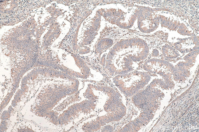 DVL3 Antibody in Immunohistochemistry (Paraffin) (IHC (P))