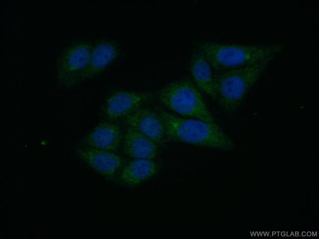 GPD1 Antibody in Immunocytochemistry (ICC/IF)