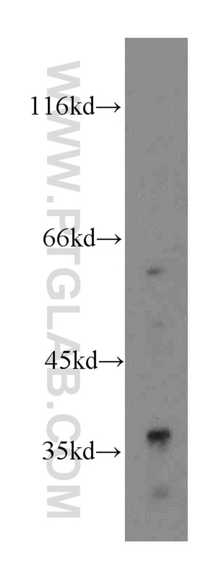 GPD1 Antibody in Western Blot (WB)