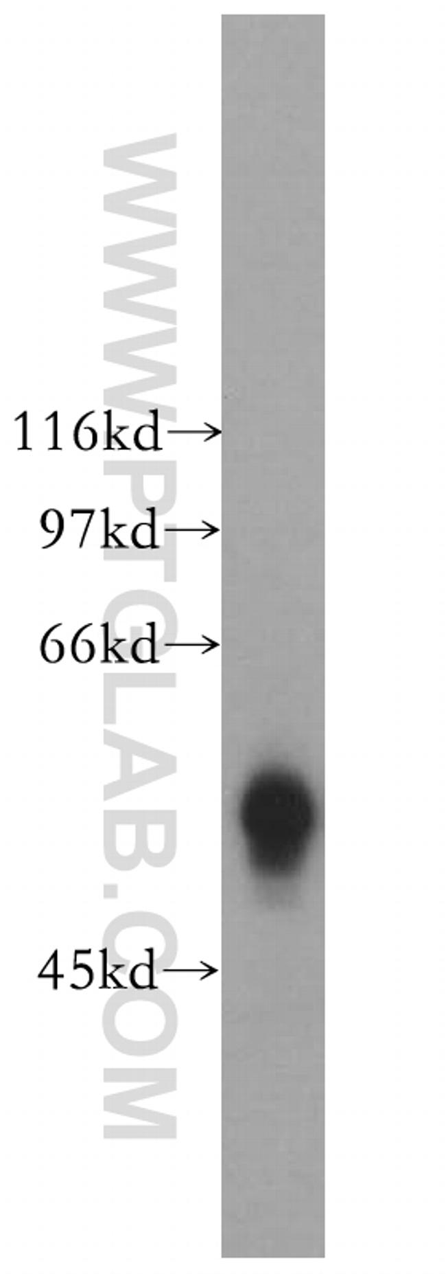 GK5 Antibody in Western Blot (WB)