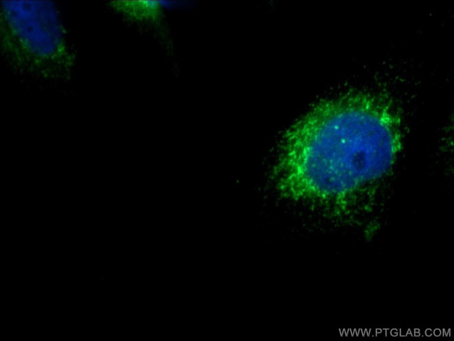 SDCCAG8 Antibody in Immunocytochemistry (ICC/IF)