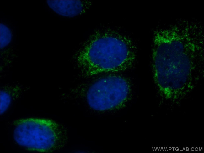 SDCCAG8 Antibody in Immunocytochemistry (ICC/IF)