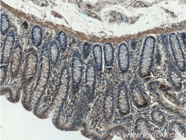 SDCCAG8 Antibody in Immunohistochemistry (Paraffin) (IHC (P))