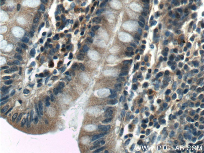 SDCCAG8 Antibody in Immunohistochemistry (Paraffin) (IHC (P))