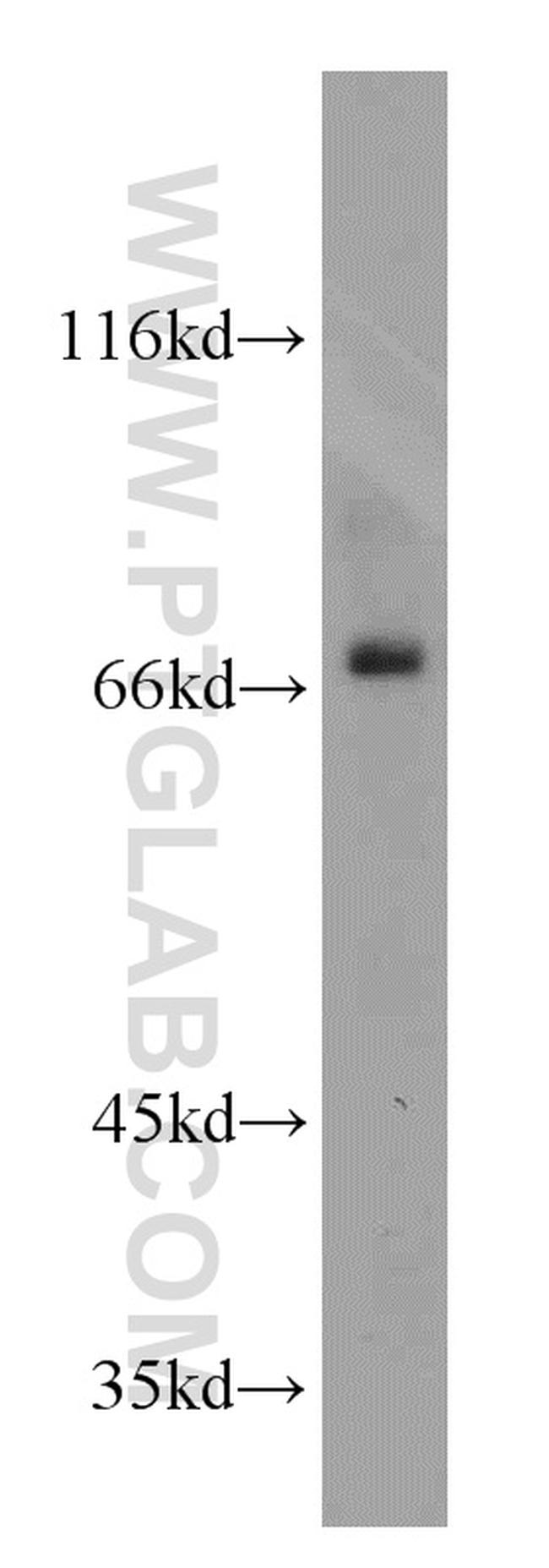 SDCCAG8 Antibody in Western Blot (WB)