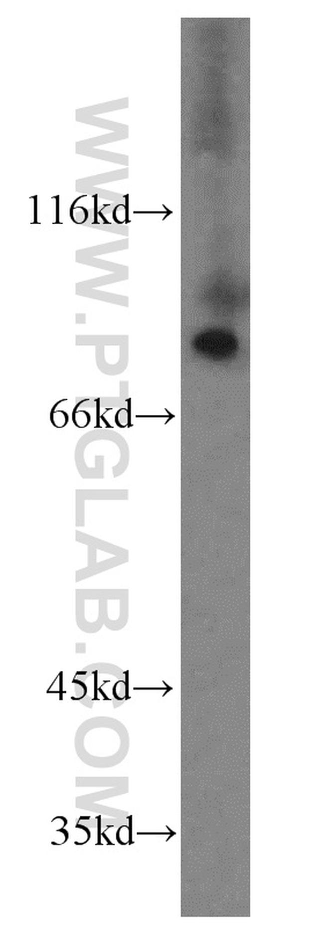 SDCCAG8 Antibody in Western Blot (WB)