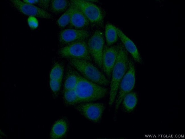 SYVN1 Antibody in Immunocytochemistry (ICC/IF)