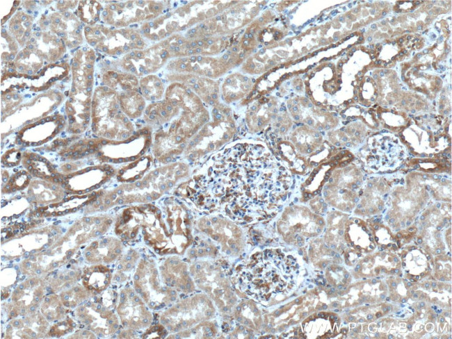 SYVN1 Antibody in Immunohistochemistry (Paraffin) (IHC (P))