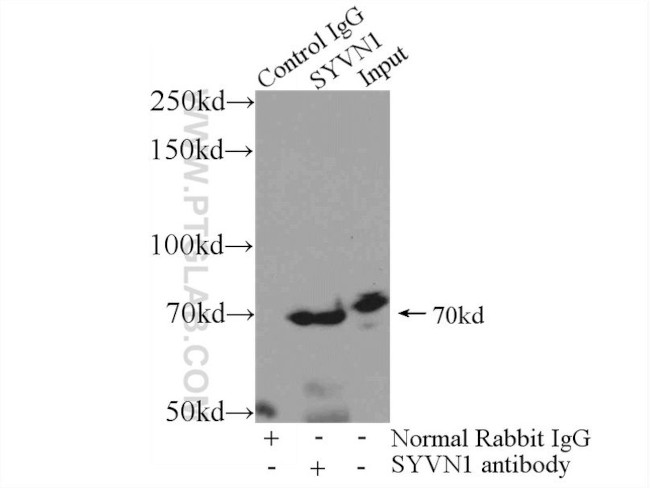 SYVN1 Antibody in Immunoprecipitation (IP)