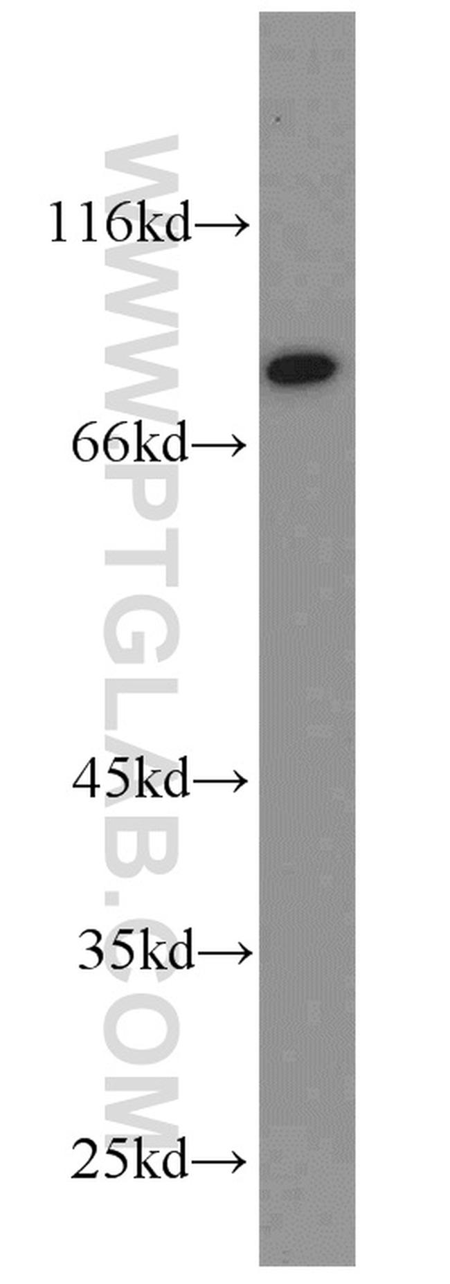 SYVN1 Antibody in Western Blot (WB)