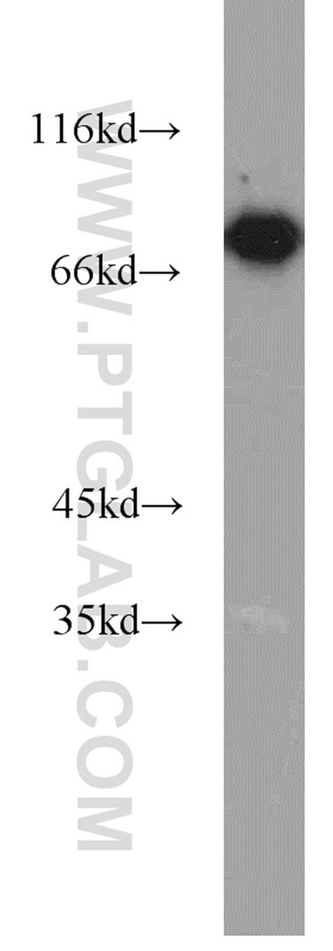 SYVN1 Antibody in Western Blot (WB)