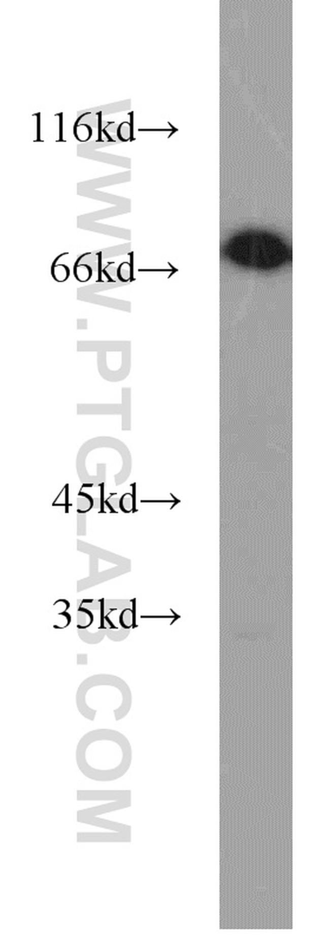 SYVN1 Antibody in Western Blot (WB)