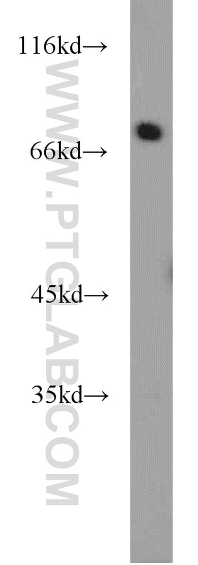 SYVN1 Antibody in Western Blot (WB)