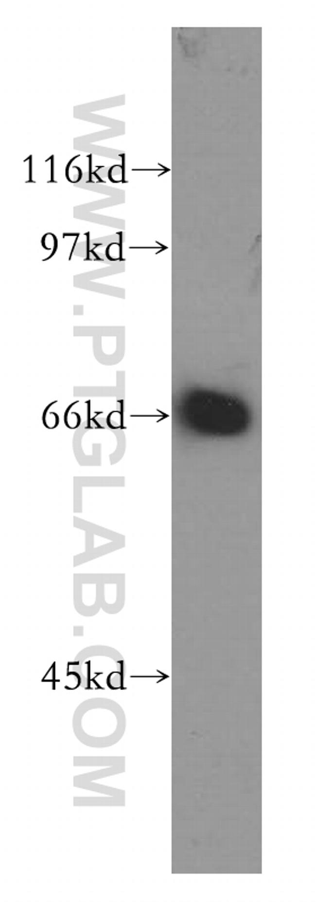 SYVN1 Antibody in Western Blot (WB)