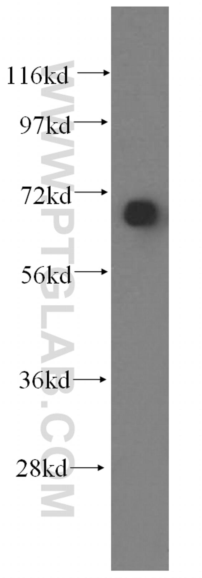 SYVN1 Antibody in Western Blot (WB)