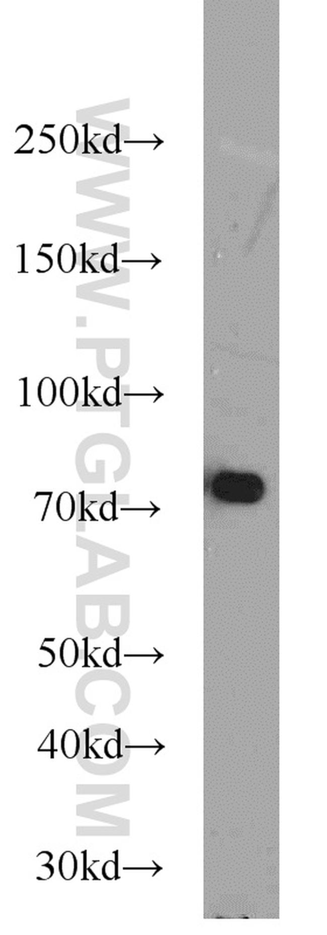 SYVN1 Antibody in Western Blot (WB)