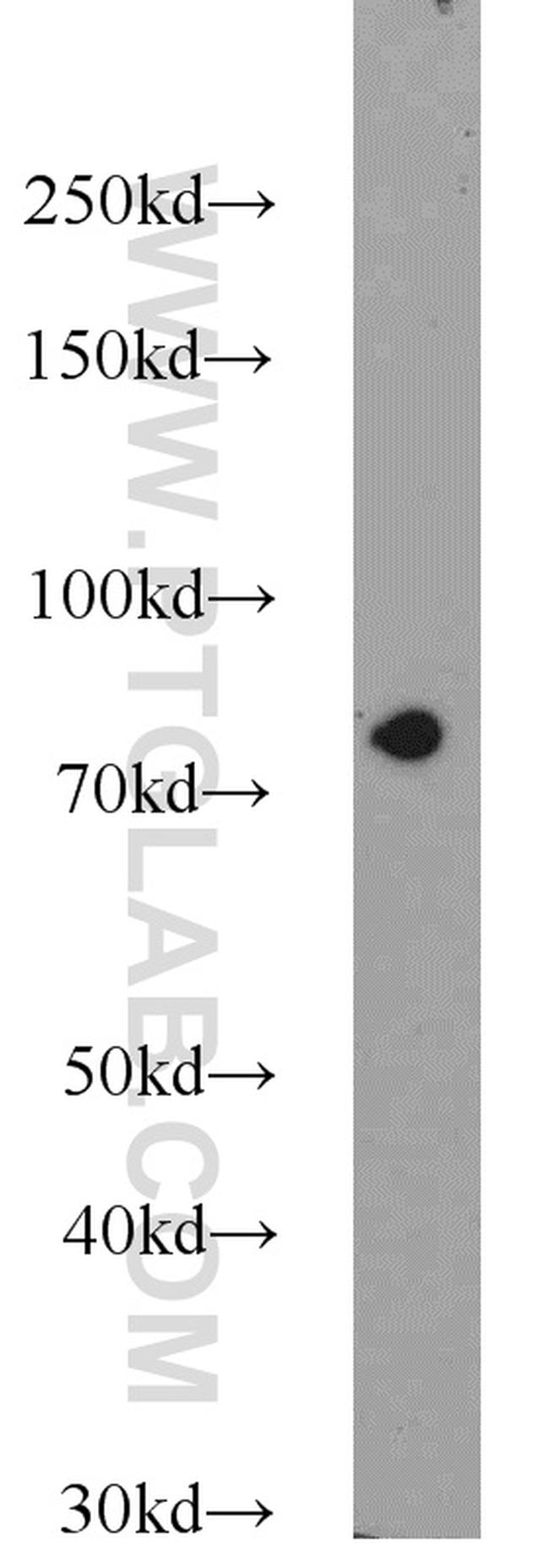 SYVN1 Antibody in Western Blot (WB)